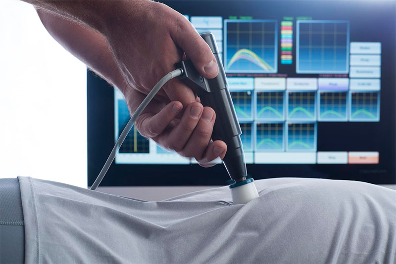 Radial Shockwave Therapy